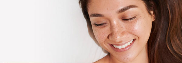 Macchie pigmentarie: cause, prevenzione, trattamento