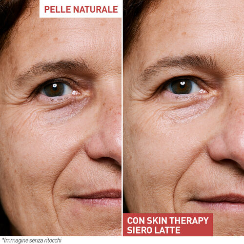 Vedi 6/11 il prodotto Skin Therapy - Siero latte multi-perfezionatore, , IT