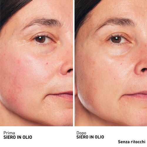 Vedi 4/9 il prodotto Skin Therapy - Siero in olio multi-perfezionatore, , IT
